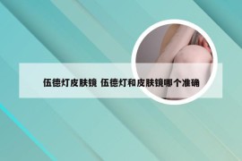 伍德灯皮肤镜 伍德灯和皮肤镜哪个准确