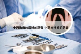 中药治癣的最好的药膏 中药治疗癣的药膏
