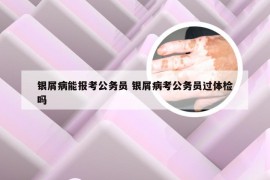 银屑病能报考公务员 银屑病考公务员过体检吗