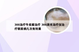 308治疗牛皮廨治疗 308激光治疗仪治疗银屑病几次有效果