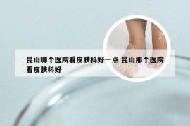 昆山哪个医院看皮肤科好一点 昆山那个医院看皮肤科好