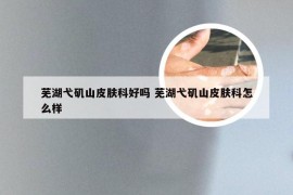 芜湖弋矶山皮肤科好吗 芜湖弋矶山皮肤科怎么样