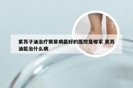紫苏子油治疗银屑病最好的医院是哪家 紫苏油能治什么病