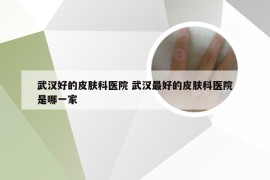 武汉好的皮肤科医院 武汉最好的皮肤科医院是哪一家