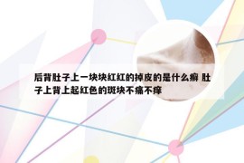 后背肚子上一块块红红的掉皮的是什么癣 肚子上背上起红色的斑块不痛不痒