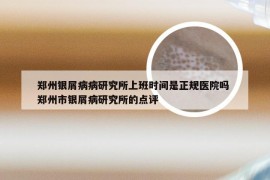 郑州银屑病病研究所上班时间是正规医院吗 郑州市银屑病研究所的点评