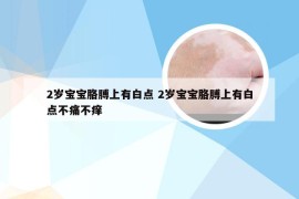 2岁宝宝胳膊上有白点 2岁宝宝胳膊上有白点不痛不痒