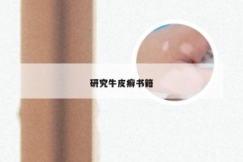 研究牛皮癣书籍