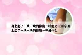 身上起了一块一块的像癣一样的又干又痒 身上起了一块一块的像癣一样是什么