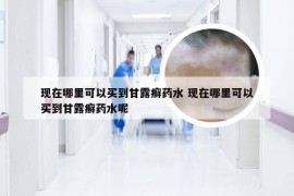 现在哪里可以买到甘露癣药水 现在哪里可以买到甘露癣药水呢
