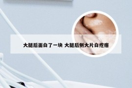 大腿后面白了一块 大腿后侧大片白疙瘩