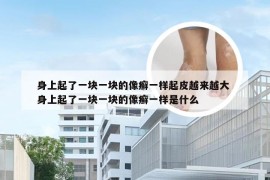 身上起了一块一块的像癣一样起皮越来越大 身上起了一块一块的像癣一样是什么
