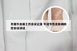 开展牛皮癣工作会议记录 牛结节性皮肤病防控会议讲话