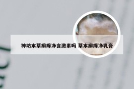 神坊本草癣痒净含激素吗 草本癣痒净乳膏