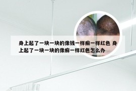 身上起了一块一块的像钱一样癣一样红色 身上起了一块一块的像癣一样红色怎么办