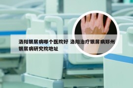 洛阳银屑病哪个医院好 洛阳治疗银屑病郑州银屑病研究院地址