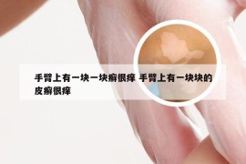 手臂上有一块一块癣很痒 手臂上有一块块的皮癣很痒