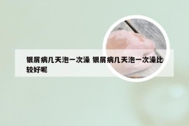 银屑病几天泡一次澡 银屑病几天泡一次澡比较好呢