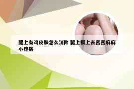 腿上有鸡皮肤怎么消除 腿上摸上去密密麻麻小疙瘩