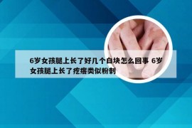 6岁女孩腿上长了好几个白块怎么回事 6岁女孩腿上长了疙瘩类似粉刺