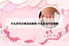 什么药可以根治皮肤癣 什么药治疗皮肤癣