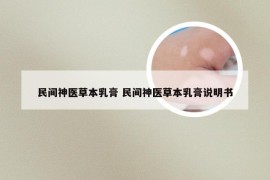民间神医草本乳膏 民间神医草本乳膏说明书