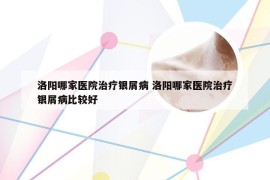 洛阳哪家医院治疗银屑病 洛阳哪家医院治疗银屑病比较好