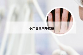 小广告又叫牛皮癣