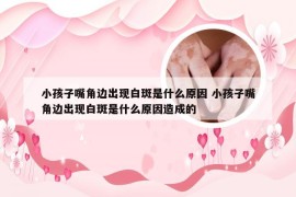 小孩子嘴角边出现白斑是什么原因 小孩子嘴角边出现白斑是什么原因造成的