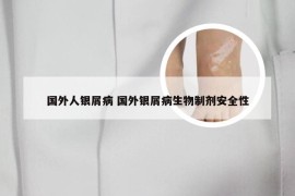 国外人银屑病 国外银屑病生物制剂安全性
