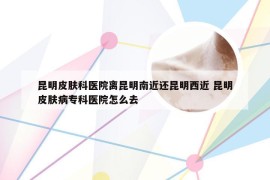 昆明皮肤科医院离昆明南近还昆明西近 昆明皮肤病专科医院怎么去