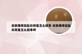皮肤瘙痒后起白斑是怎么回事 皮肤瘙痒后起白斑是怎么回事啊