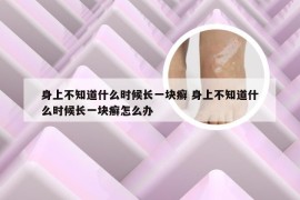 身上不知道什么时候长一块癣 身上不知道什么时候长一块癣怎么办