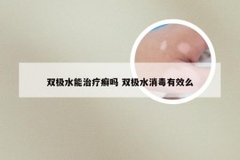 双极水能治疗癣吗 双极水消毒有效么