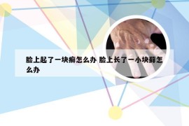 脸上起了一块癣怎么办 脸上长了一小块藓怎么办
