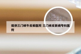 提供三门峡牛皮癣医院 三门峡皮肤病专科医院