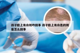 孩子脸上有白班咋回事 孩子脸上有白色的斑是怎么回事