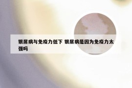 银屑病与免疫力低下 银屑病是因为免疫力太强吗