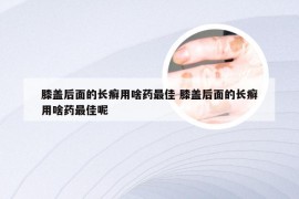 膝盖后面的长癣用啥药最佳 膝盖后面的长癣用啥药最佳呢