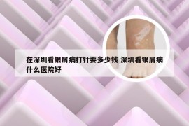 在深圳看银屑病打针要多少钱 深圳看银屑病什么医院好