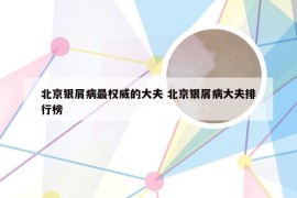 北京银屑病最权威的大夫 北京银屑病大夫排行榜