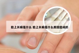脸上长癣是什么 脸上长癣是什么原因造成的