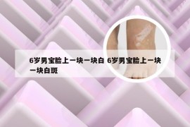 6岁男宝脸上一块一块白 6岁男宝脸上一块一块白斑