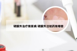 硬膜外治疗银屑病 硬膜外注射药有哪些