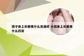 孩子身上长癣用什么洗澡好 小孩身上长癣用什么药膏