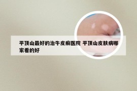 平顶山最好的治牛皮癣医院 平顶山皮肤病哪家看的好