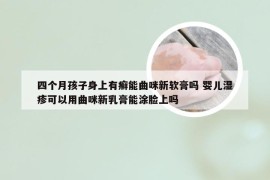 四个月孩子身上有癣能曲咪新软膏吗 婴儿湿疹可以用曲咪新乳膏能涂脸上吗
