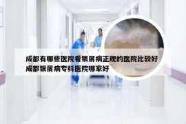 成都有哪些医院看银屑病正规的医院比较好 成都银屑病专科医院哪家好