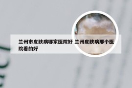 兰州市皮肤病哪家医院好 兰州皮肤病那个医院看的好