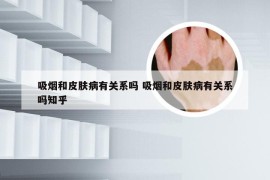 吸烟和皮肤病有关系吗 吸烟和皮肤病有关系吗知乎